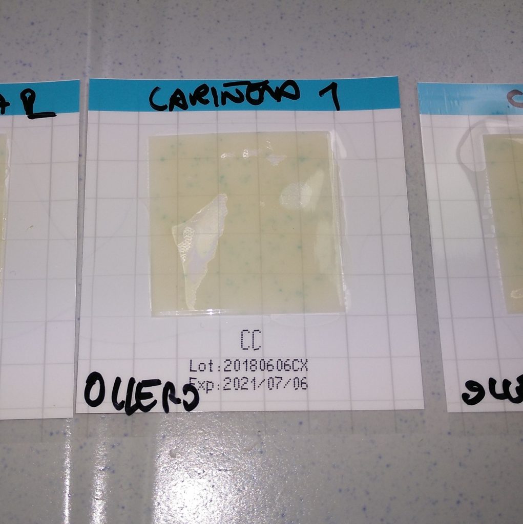 Ejemplo de placa de cultivo de coliformes